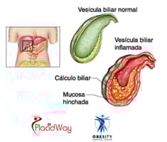 Slider image (7) Obesity Surgical Center | Dr. Jorge Reyes Mendiola
